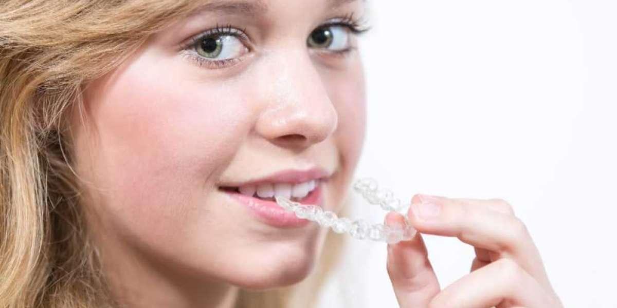 The Ultimate Guide to Modern Dental Implants